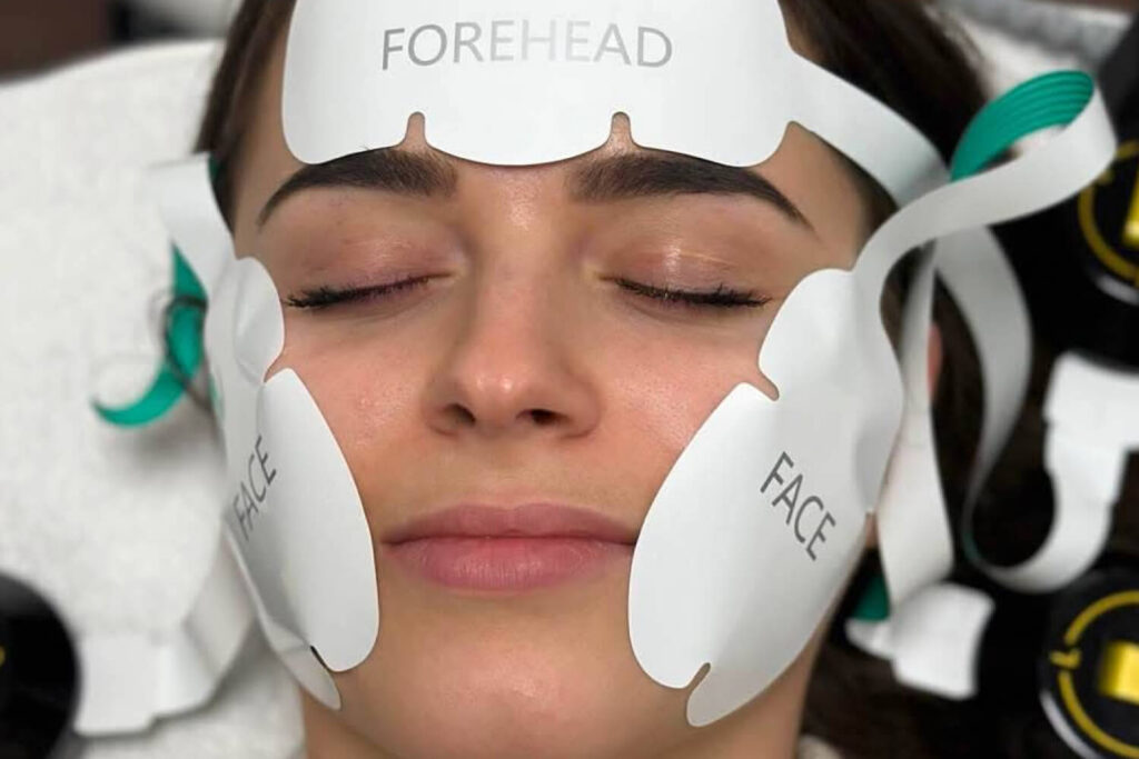 EMRF FaceLifting kezelés, arckezelés